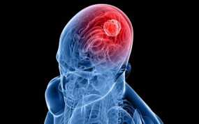 Οι επιστήμονες αναχαιτίζουν τον καρκίνο στο κεφάλι