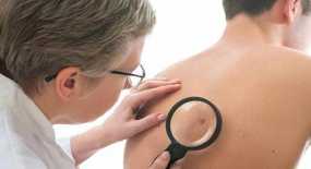 Ελιές στο δέρμα: Τα 5 σημάδια που δείχνουν κίνδυνο για καρκίνο
