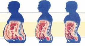 Παχυσαρκία: Ποιες αλλαγές προκαλεί στη δομή του εγκεφάλου
