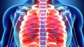 Καρκίνος του πνεύμονα: Κρίσιμος ο ετήσιος προσυμπτωματικός έλεγχος με αξονική