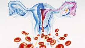 Καρκίνος ενδομητρίου: Τα 5 προειδοποιητικά σημάδια που πρέπει να γνωρίζουν οι γυναίκες