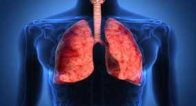 Προσοχή στον βήχα που «γυρνάει» σε πνευμονία - Ποια τα συμπτώματα