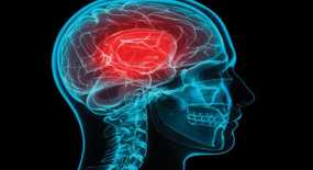 Δείτε τα βασικά συμπτώματα του εγκεφαλικού - Πως να τα καταλάβετε