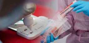 Κορονοϊός: Γιατί μπορεί το PCR να βγαίνει θετικό και το rapid test αρνητικό