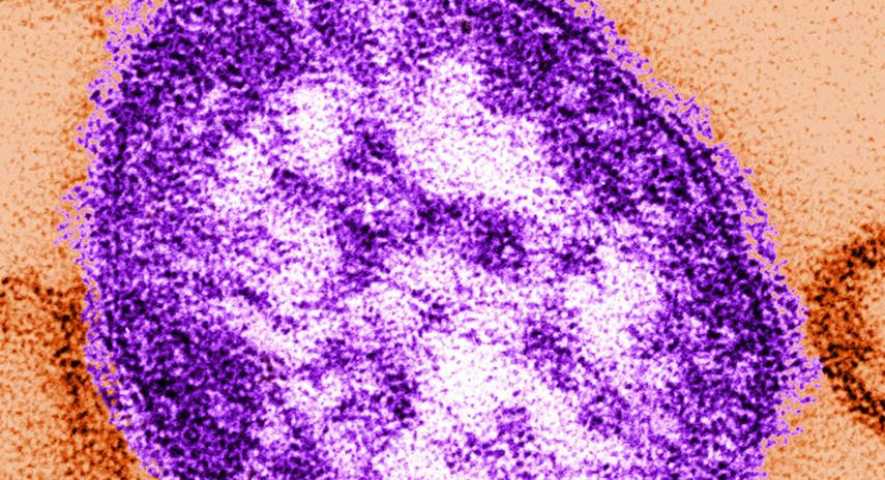 Ο ΠΟΥ προειδοποιεί: Έξαρση της ιλαράς στην Ευρώπη