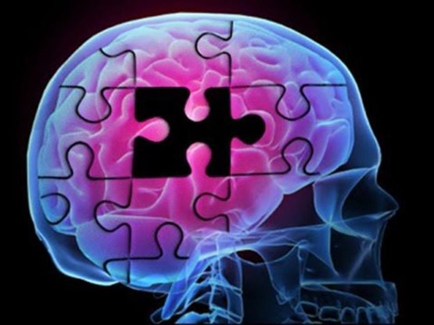 Αλτσχάιμερ: Ο εγκέφαλος «αντισταθμίζει» τις πρώιμες βλάβες