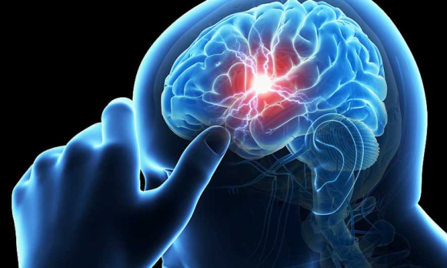 Έρευνα: Η ασπιρίνη μπορεί να μας σώσει ακόμη και από εγκεφαλικό